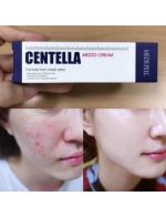 MEDI-PEELl Melanon X Centella Mezzo Cream Brightening Whitening Freckle 30ml. (Blue) ѡᴧҡ֡ҡǼҧ բ ЪѺ٢ ʡѴҡҵԪѡءԴ Ŵ ´ ᴧ 