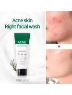 *พร้อมส่ง*SOME BY MI AHA-BHA-PHA 30 Days Miracle Acne Clear Foam 100 ml. ใหม่! โฟมล้างหน้าใหม่จาก ซัม บาย มี สำหรับผู้มีปัญหาสิว ด้วย AHA, BHA และ PHA ช่วยทำให้ผิวกระจ่างใสและสุขภาพดีอย่างสม่ำเสมอ โดยการขจัดเซลล์ที่ตายแล้วและสิ่งสกปรกออก และปรับอัตราการผล *พร้อมส่ง*SOME BY MI AHA-BHA-PHA 30 Days Miracle Acne Clear Foam 100 ml. ใหม่! โฟมล้างหน้าใหม่จาก ซัม บาย มี สำหรับผู้มีปัญหาสิว ด้วย AHA, BHA และ PHA ช่วยทำให้ผิวกระจ่างใสและสุขภาพดีอย่างสม่ำเสมอ โดยการขจัดเซลล์ที่ตายแล้วและสิ่งสกปรกออก และปรับอัตราการผล